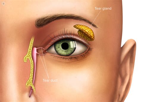 What causes a blocked tear duct? | Top Doctors