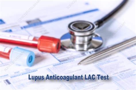 Lupus anticoagulant test, conceptual image - Stock Image - F037/1182 ...