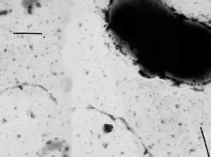 Sulfate reducing bacteria | Ask Microbiology