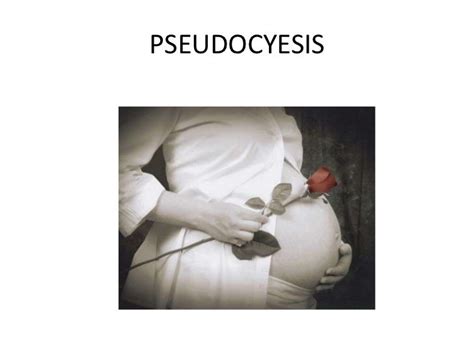 Pseudocyesis final