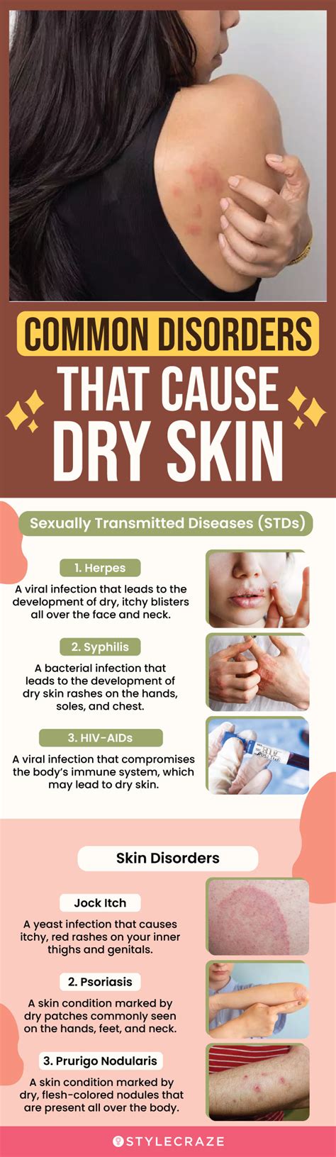 STDs That Cause Dry Skin: A Complete Guide