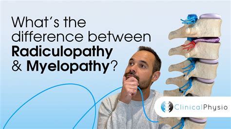 What’s the difference between Radiculopathy and Myelopathy? | Expert Physio Guide - YouTube