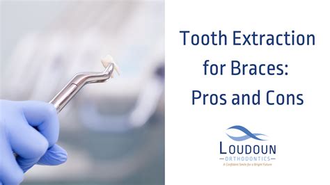 Tooth Extraction for Braces: Pros and Cons