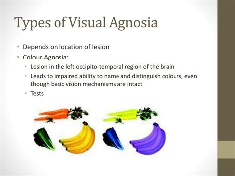 PPT - Agnosia PowerPoint Presentation, free download - ID:2678587