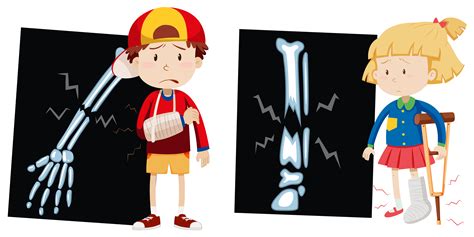 Boy and girl with broken bones 300134 Vector Art at Vecteezy