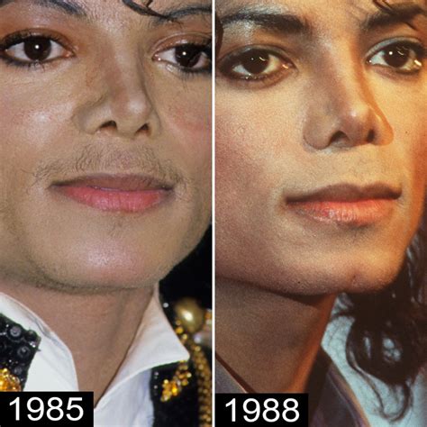 Michael Jackson's Plastic Surgery — See His Transformation