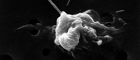 Turmeric Curcumin Reprogramming Cancer Cell Death