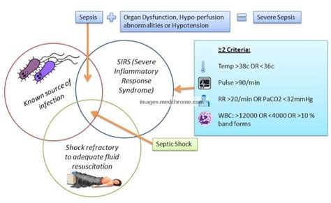 Sepsis Sirs Mods Body Disorders Medical Science Medical | Hot Sex Picture