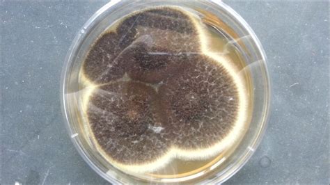 Aspergillus niger Colony Morphology on Sabouraud Dextrose Agar (SDA ...