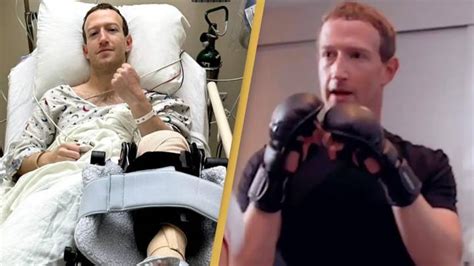 Facebook's Mark Zuckerberg undergoes surgery after sustaining injury ...