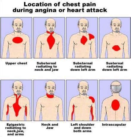 Location of chest pain during angina or heart attack - Health Blog Centre Info