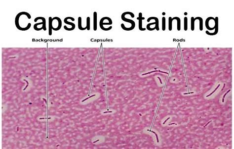 Capsule Staining- Principle, Reagents, Procedure and Result. The main purpose of capsule stain ...