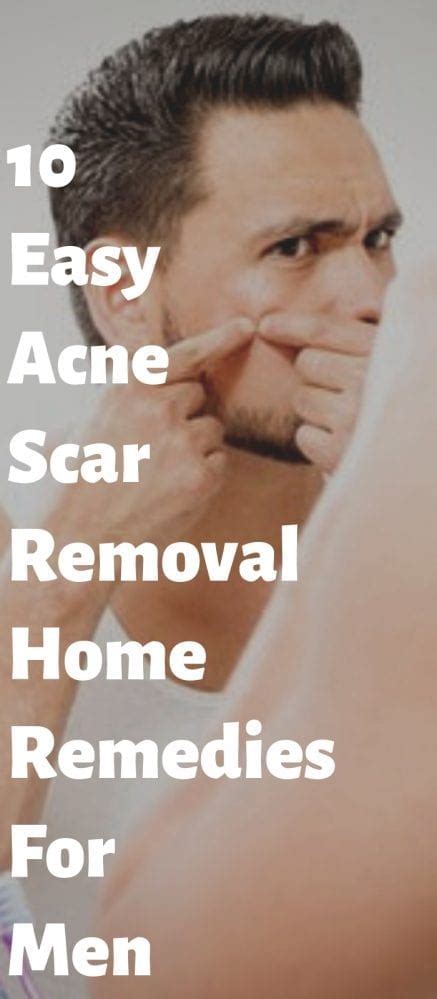 10 Easy Acne Scar Removal Home Remedies For Men. ⋆ Best Fashion Blog ...