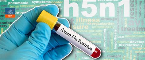 Bird Flu: 5 Precautions To Combat H5N1 Virus - Health & Sports