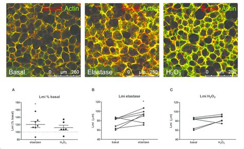 | Elastase, but not H 2 O 2 treatment increases Lmi. PCLS were exposed ...