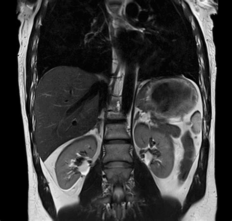 body-mri-2 – MRI Scan & Imaging Center