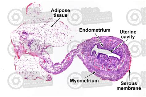 Uterus Histology Diagram