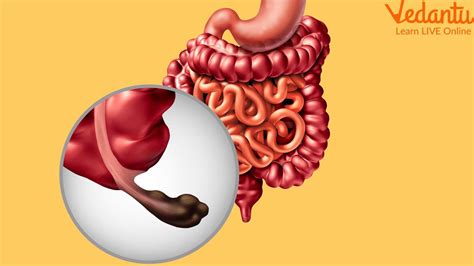 What is an Appendix? - Function, Location & Use