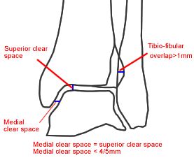 medial clear space ankle - Google Search | Anatomi