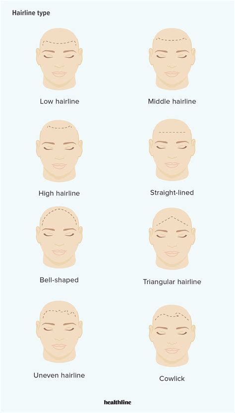 Normal Hairline: How It Looks Compared to Receding