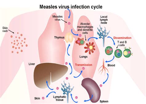 Measles and Immune Amnesia