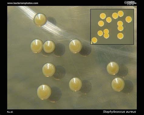 Staphylococcus aureus colonies on tryptic soy agar | Things only a Med ...