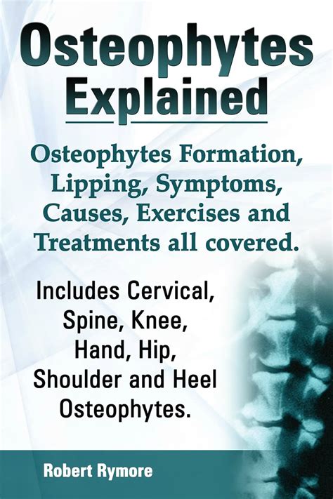 Osteophytes explained. Osteophytes Formation, Lipping, Symptoms, Causes, Exercises and ...