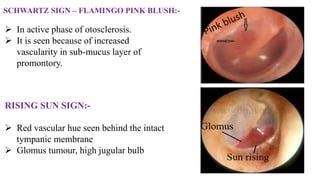 ear examination.pptx