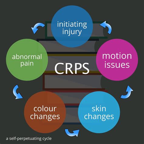 Why re-injury is common in CRPS patients | KNEEguru