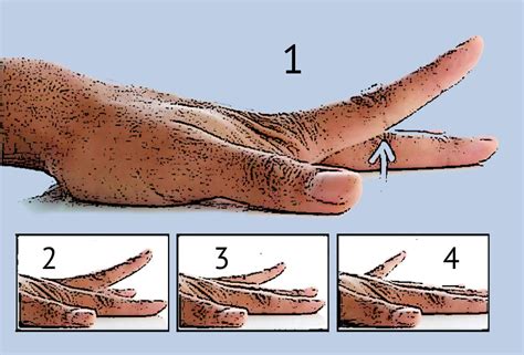 7 Physical Therapy Finger Exercises After Injury | Fort Worth Hand Center