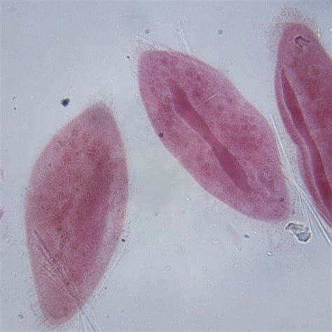 Where Do Bacteria Live? | Sciencing