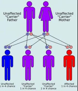 Gaucher Disease: Causes, Symptoms, And Treatments