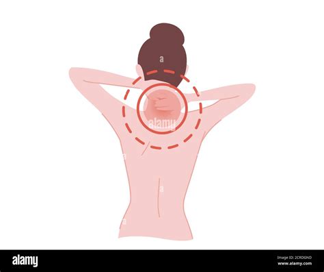 Painful neck concept with human pain circles on back of the neck cartoon flat design vector ...