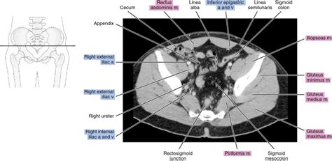 CT of the male pelvis | Radiology Key