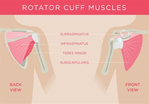 Pros and Cons of Reverse Shoulder Replacement Surgery