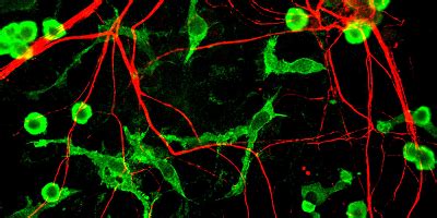 Institute of Experimental Neurology - HSR Research