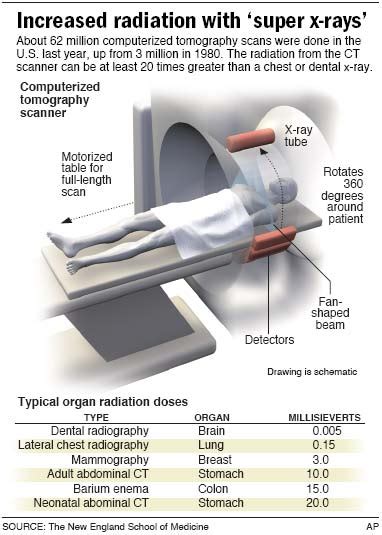 radiation from CT scans