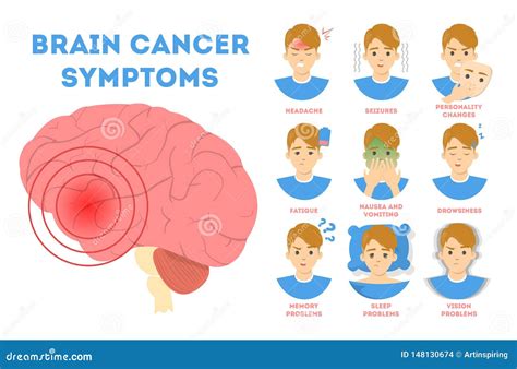 Brain Cancer Symptoms Infographic. Nausea and Vision Stock Vector ...