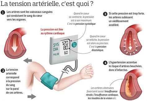 Hypertension artérielle : Cause, symptôme et traitement - LeChatSur.fr