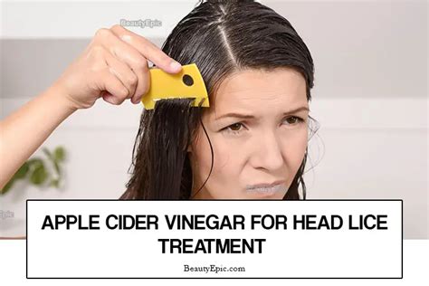 How To Treat Head Lice With Apple Cider Vinegar?