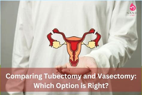 Comparing Tubectomy and Vasectomy: Which Option is Right? - Nandi IVF