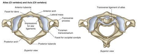 Atlas and Axis - Differential Diagnosis of