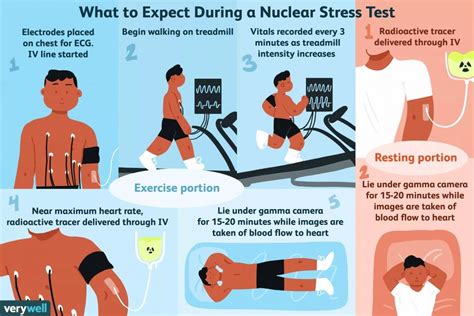 nuclear stress test - THW Cardiology Center in Maple