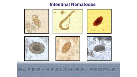 Diagnostic Features of Intestinal Nematodes - YouTube