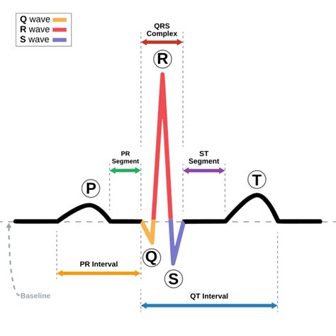 Sinus rhythm - Wikipedia