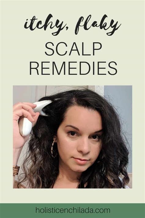 itchy-flaky-scalp-remedies - The Holistic Enchilada - Curly Hair ...