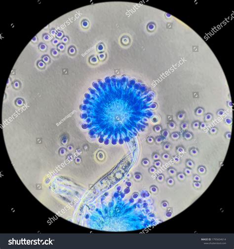 Aspergillus Flavus Fungal Phase Contrast Microscopy Stock Photo ...