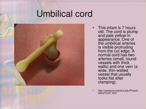 Umbilical Cord Color