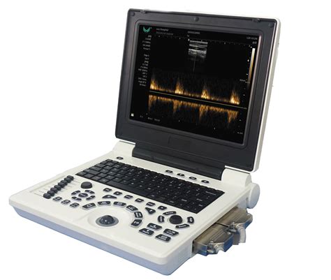 Portable Ultrasound Machines/ Sonoscape E20 Doppler Ultrasound Scannser - China Safety Features ...