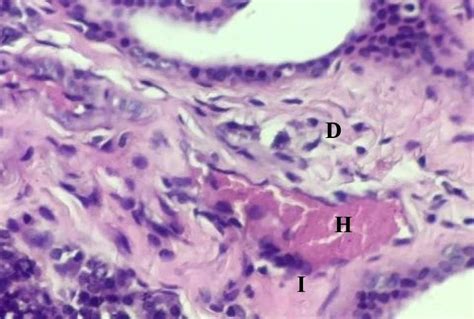 2 nd group parotid salivary gland of rabbit section shows: great ...